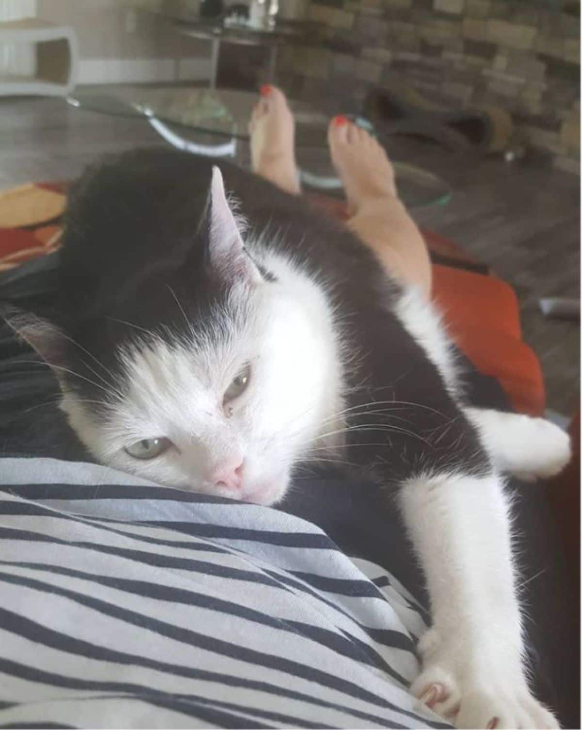 black and white cat laying on a person